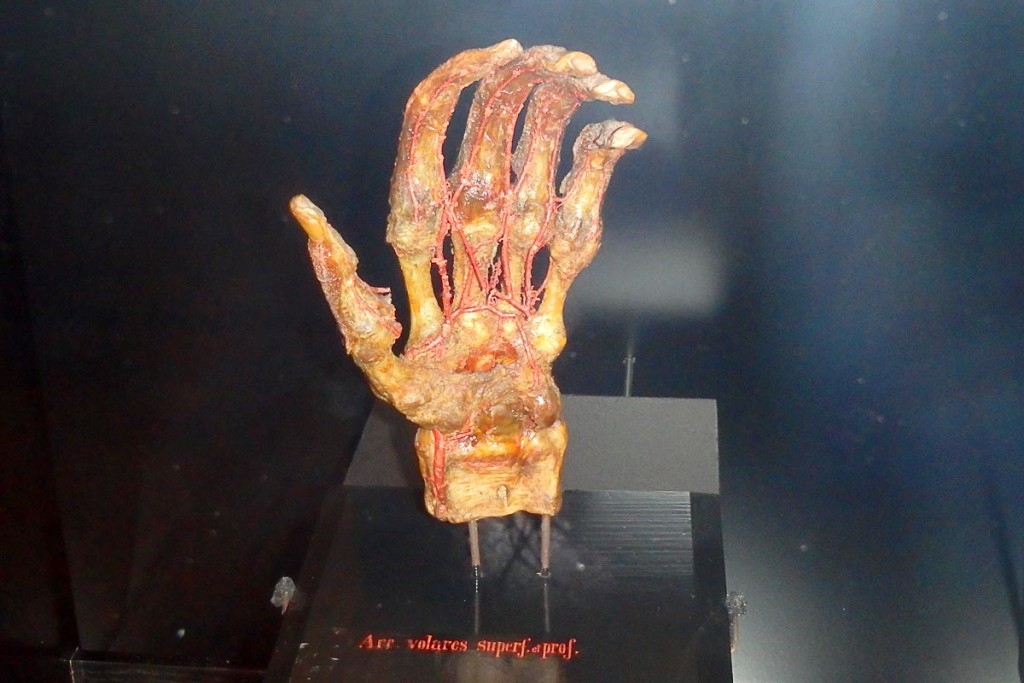 If I understood correctly, this is an actual centuries-old human hand in the Tartu Cathedral museum.