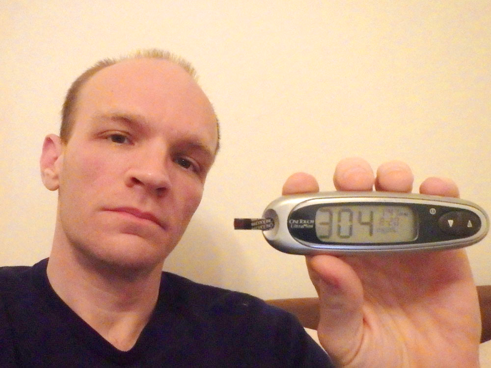 #bgnow 304. All that juice and Twix must have hit me at once. I wish blood would just take the sugar as I ate it, not wait dramatically for some point in the future.